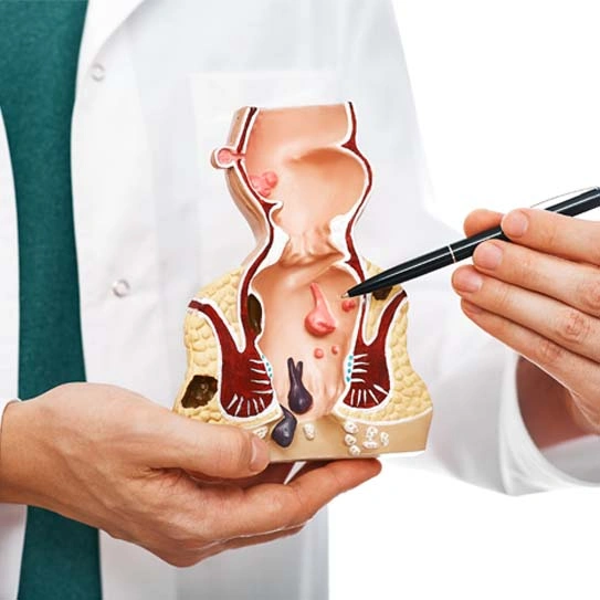 Fistula Surgery in Chhattisgarh