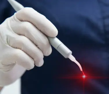 Piles Laser Surgery in Chhattisgarh